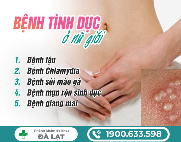 Hình ảnh minh họa